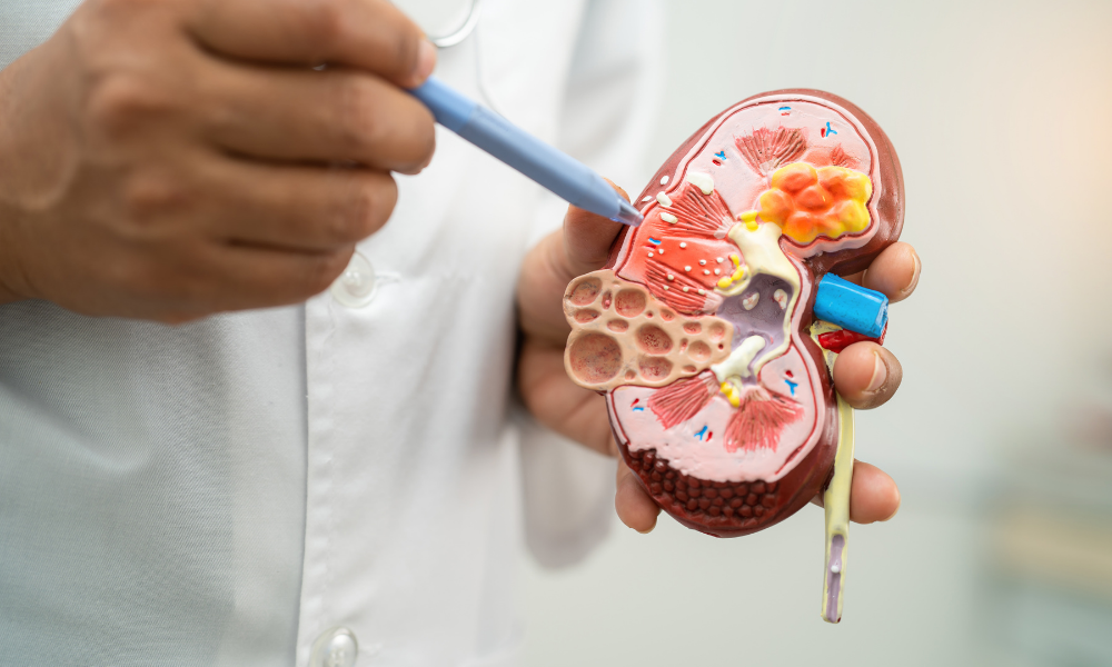 Urology – Kidney and Urology Super Speciality Institute – Pune